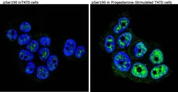 Anti-Progesterone Receptor (phospho Ser190) antibody [1154] used in Immunocytochemistry/ Immunofluorescence (ICC/IF). GTX30164