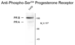 Anti-Progesterone Receptor (phospho Ser294) antibody [608] used in Western Blot (WB). GTX30165