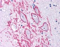 Anti-Neurokinin 1 Receptor antibody used in IHC (Paraffin sections) (IHC-P). GTX30183
