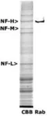 Anti-NF-H antibody used in Western Blot (WB). GTX30192