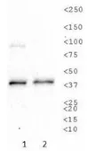Anti-Sodium/Potassium ATPase beta 1 antibody [464.8(8A)] used in Western Blot (WB). GTX30203