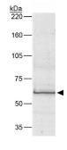 Anti-Bestrophin antibody [E6-6] used in Western Blot (WB). GTX30219