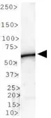 Anti-PLTP antibody used in Western Blot (WB). GTX30230