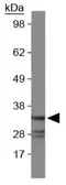 Anti-Caspase 7 antibody [Mch3 1-1-11] used in Western Blot (WB). GTX30242