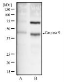 Anti-Caspase 9 antibody [LAP6 96-2-22] used in Western Blot (WB). GTX30245