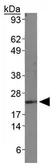 Anti-Diablo antibody [78-1-118] used in Western Blot (WB). GTX30249