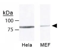 Anti-Mre11 antibody used in Western Blot (WB). GTX30294
