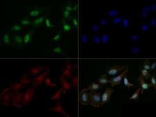 Anti-Mre11 antibody used in Immunocytochemistry/ Immunofluorescence (ICC/IF). GTX30294