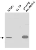 Anti-CDKN2A / p14ARF antibody used in Western Blot (WB). GTX30433