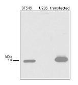 Anti-CDKN2A / p14ARF antibody used in Western Blot (WB). GTX30434
