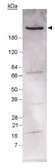 Anti-Fatty Acid Synthase antibody used in Western Blot (WB). GTX30468