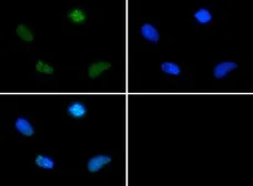 Anti-Survivin (phospho Thr34) antibody used in Immunocytochemistry/ Immunofluorescence (ICC/IF). GTX30488