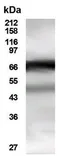 Anti-HDAC10 antibody used in Western Blot (WB). GTX30496