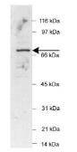Anti-POT1 antibody used in Western Blot (WB). GTX30601