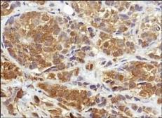 Anti-NQO1 antibody [A180] used in IHC (Paraffin sections) (IHC-P). GTX30626