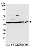 Anti-beta Actin antibody used in Western Blot (WB). GTX30632