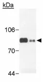 Anti-RNase L antibody [2E9] used in Western Blot (WB). GTX30638