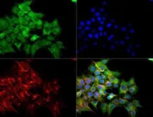 Anti-VEGF Receptor 2 antibody used in Immunocytochemistry/ Immunofluorescence (ICC/IF). GTX30654