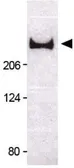Anti-53BP1 antibody used in Western Blot (WB). GTX30658