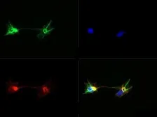 Anti-Nestin antibody used in Immunocytochemistry/ Immunofluorescence (ICC/IF). GTX30670