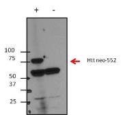 Anti-Huntingtin (neoepitope 552) antibody [4-13] used in Western Blot (WB). GTX30673