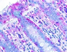 Anti-ChREBP antibody used in IHC (Paraffin sections) (IHC-P). GTX30677