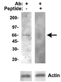 Anti-CYP46A1 antibody used in Western Blot (WB). GTX30682