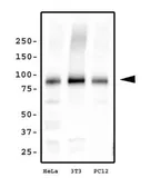 Anti-KIF2A antibody used in Western Blot (WB). GTX30691