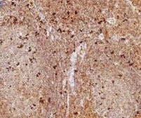Anti-FOXP3 antibody used in IHC (Paraffin sections) (IHC-P). GTX30696