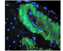Anti-Nitrotyrosine antibody [39B6] used in IHC (Paraffin sections) (IHC-P). GTX30730