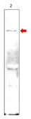 Anti-PDE10A antibody used in Western Blot (WB). GTX30756