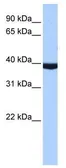 Anti-PAX2 antibody, Internal used in Western Blot (WB). GTX30760