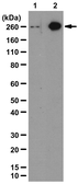 Anti-Acetyl-CoA Carboxylase 1 (phospho Ser79) antibody used in Western Blot (WB). GTX30764