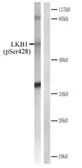 Anti-LKB1 (phospho Ser428) antibody used in Western Blot (WB). GTX30765