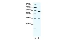 Anti-GDI1 antibody, C-term used in Western Blot (WB). GTX30781