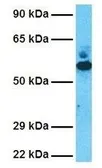 Anti-GDI2 antibody, C-term used in Western Blot (WB). GTX30782
