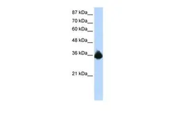 Anti-PTBP2 antibody, N-term used in Western Blot (WB). GTX30786