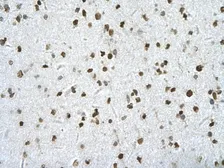 Anti-HIPK2 antibody, Internal used in IHC (Paraffin sections) (IHC-P). GTX30803