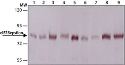 Anti-EIF2B epsilon antibody used in Western Blot (WB). GTX30808