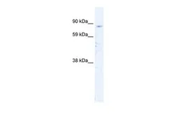 Anti-SIRT1 antibody, N-term used in Western Blot (WB). GTX30870