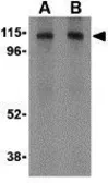 Anti-LAMP2 antibody used in Western Blot (WB). GTX30881