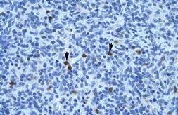 Anti-Annexin III antibody, N-term used in IHC (Paraffin sections) (IHC-P). GTX30892