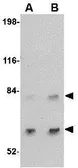 Anti-SATB2 antibody used in Western Blot (WB). GTX30894