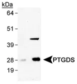 Anti-PTGDS antibody used in Western Blot (WB). GTX30911