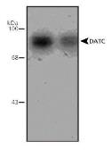 Anti-Dopamine Transporter antibody, C-Term used in Western Blot (WB). GTX30998