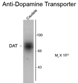 Anti-Dopamine Transporter antibody, C-Term used in Western Blot (WB). GTX30998