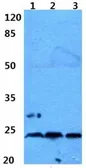 Anti-Ephrin A2 antibody used in Western Blot (WB). GTX30999