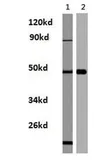 Anti-Histamine H3 Receptor antibody used in Western Blot (WB). GTX31041