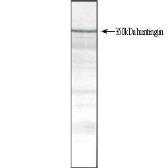 Anti-Huntingtin antibody [HDB4E10] used in Western Blot (WB). GTX31045