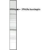 Anti-Huntingtin antibody [HDC8A4] used in Western Blot (WB). GTX31046